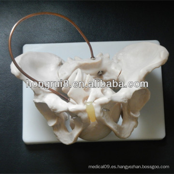 Modelo de pelvis femenino ISO con cráneo fetal, Simulador de demostración de partería